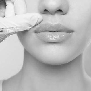 Dermal fillers