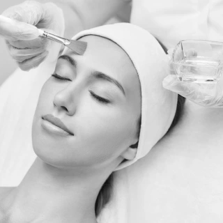 chemical peels treatment in Thane