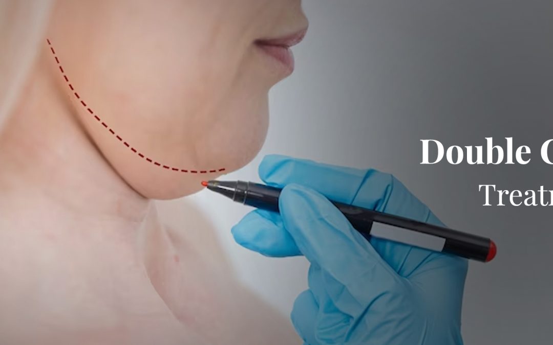 Best Double Chin Treatment in Thane