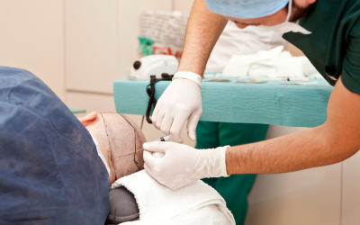 Best Hair Transplant in Bandra – Experience Excellence with Dr. Sagar Daiv